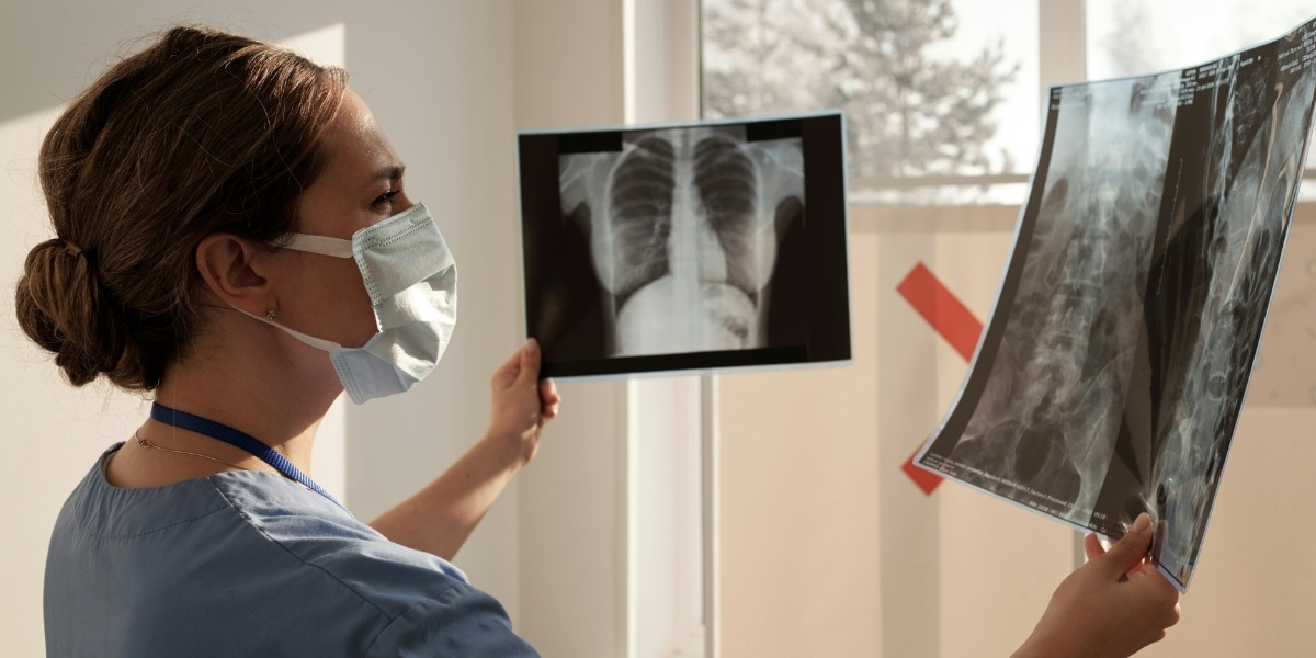 How Digital X-rays Support Better Diagnosis