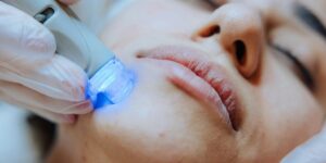 How Skin Resurfacing Can Transform Your Skin Texture