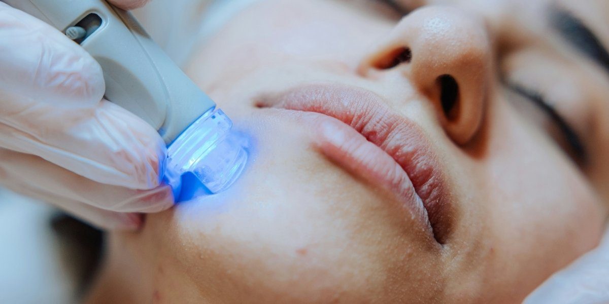 How Skin Resurfacing Can Transform Your Skin Texture