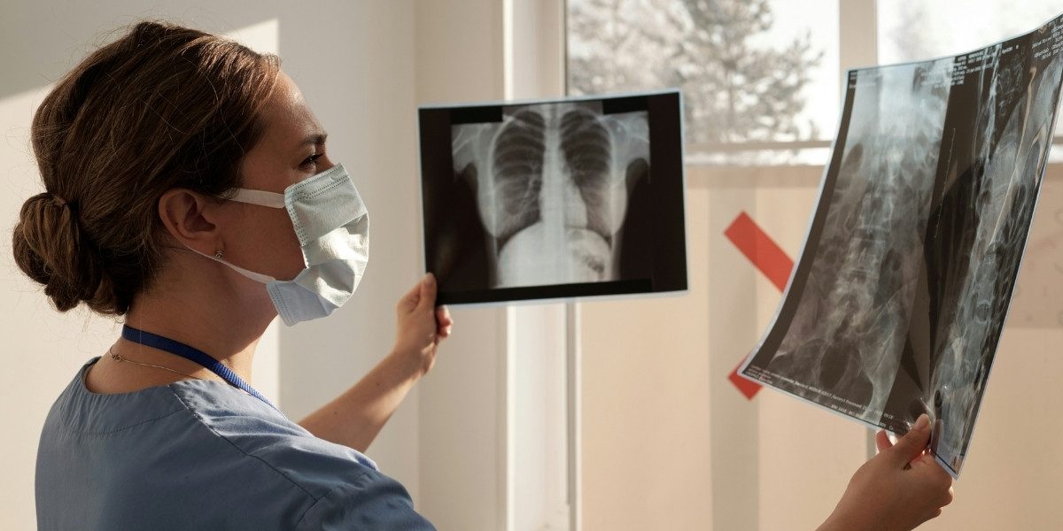 How Digital X-rays Support Better Diagnosis